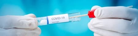 Reducere tarife testare RT-PCR si Antigen COVID-19