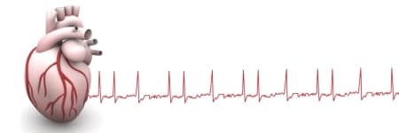 Fibrilația atrială